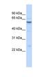 Insulin Like Growth Factor Binding Protein Acid Labile Subunit antibody, orb330227, Biorbyt, Western Blot image 