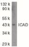 DNA Fragmentation Factor Subunit Alpha antibody, PA5-19889, Invitrogen Antibodies, Western Blot image 