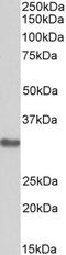 RP3 antibody, PA5-19254, Invitrogen Antibodies, Western Blot image 