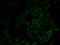Moesin antibody, STJ24619, St John