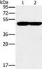 Protoporphyrinogen Oxidase antibody, PA5-50733, Invitrogen Antibodies, Western Blot image 
