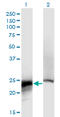 Crystallin Beta B2 antibody, LS-C196974, Lifespan Biosciences, Western Blot image 