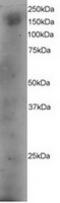 Dedicator of cytokinesis protein 1 antibody, TA302729, Origene, Western Blot image 