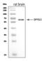 Drp3 antibody, A05960-1, Boster Biological Technology, Western Blot image 
