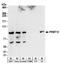Protein Arginine Methyltransferase 9 antibody, A304-190A, Bethyl Labs, Western Blot image 