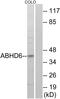 Monoacylglycerol lipase ABHD6 antibody, PA5-38999, Invitrogen Antibodies, Western Blot image 