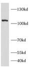 Dipeptidyl Peptidase 4 antibody, FNab02520, FineTest, Western Blot image 