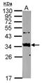 Sftpa antibody, NBP2-15130, Novus Biologicals, Western Blot image 