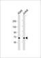 Coagulation Factor XI antibody, 55-918, ProSci, Western Blot image 