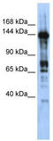 Zinc finger protein castor homolog 1 antibody, TA331883, Origene, Western Blot image 