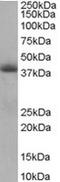 Translocase Of Inner Mitochondrial Membrane 50 antibody, TA302964, Origene, Western Blot image 