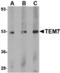 Plexin Domain Containing 1 antibody, A08584-1, Boster Biological Technology, Western Blot image 