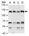 Chromodomain Helicase DNA Binding Protein 1 Like antibody, GTX129527, GeneTex, Western Blot image 