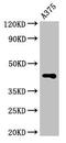 Aurora Kinase C antibody, CSB-PA002460LA01HU, Cusabio, Western Blot image 