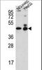 Actin-like protein 6B antibody, LS-B12788, Lifespan Biosciences, Western Blot image 