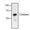 Catalase antibody, AHP2290, Bio-Rad (formerly AbD Serotec) , Western Blot image 