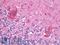 Short palate, lung and nasal epithelium carcinoma-associated protein 2 antibody, LS-B9833, Lifespan Biosciences, Immunohistochemistry frozen image 