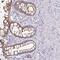 Ankyrin Repeat Domain 29 antibody, PA5-61962, Invitrogen Antibodies, Immunohistochemistry frozen image 