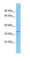 Speedy/RINGO Cell Cycle Regulator Family Member C antibody, orb327110, Biorbyt, Western Blot image 