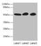 GDP Dissociation Inhibitor 2 antibody, CSB-PA009354LA01HU, Cusabio, Western Blot image 