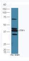 NK2 Homeobox 1 antibody, orb186420, Biorbyt, Western Blot image 