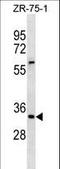 Inhibitor Of Growth Family Member 2 antibody, LS-C157837, Lifespan Biosciences, Western Blot image 