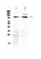 Short transient receptor potential channel 6 antibody, A00625, Boster Biological Technology, Western Blot image 