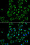 Peroxisomal Biogenesis Factor 5 antibody, 19-855, ProSci, Immunofluorescence image 
