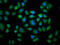 Cytochrome P450 Family 2 Subfamily C Member 19 antibody, LS-C669980, Lifespan Biosciences, Immunofluorescence image 