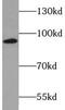 Protein Kinase C Epsilon antibody, FNab06484, FineTest, Western Blot image 
