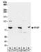 6-phosphofructokinase type C antibody, NBP2-32192, Novus Biologicals, Western Blot image 
