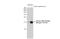 H2A Histone Family Member X antibody, GTX127340, GeneTex, Western Blot image 