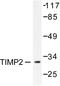 Metalloproteinase inhibitor 2 antibody, AP06355PU-N, Origene, Western Blot image 