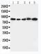Integrin Subunit Beta 2 antibody, LS-C312785, Lifespan Biosciences, Western Blot image 