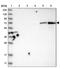 Hexosaminidase D antibody, PA5-54615, Invitrogen Antibodies, Western Blot image 