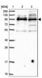 Spire Type Actin Nucleation Factor 1 antibody, NBP1-92438, Novus Biologicals, Western Blot image 