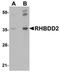 Rhomboid domain-containing protein 2 antibody, orb75327, Biorbyt, Western Blot image 