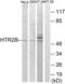 5-Hydroxytryptamine Receptor 2B antibody, LS-B9273, Lifespan Biosciences, Western Blot image 