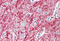 TNF Superfamily Member 13 antibody, MBS242783, MyBioSource, Immunohistochemistry frozen image 