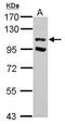 Ubiquitin carboxyl-terminal hydrolase 37 antibody, GTX118769, GeneTex, Western Blot image 