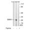 Homeobox protein EMX1 antibody, A06307, Boster Biological Technology, Western Blot image 