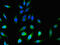 Chromosome 1 Open Reading Frame 189 antibody, LS-C399161, Lifespan Biosciences, Immunofluorescence image 