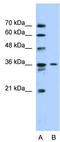 Solute Carrier Family 35 Member A3 antibody, TA333883, Origene, Western Blot image 