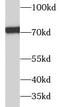 Replication Protein A1 antibody, FNab07391, FineTest, Western Blot image 