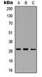 Matrix Metallopeptidase 26 antibody, MBS8236784, MyBioSource, Western Blot image 