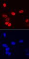 Sp7 Transcription Factor antibody, MAB7547, R&D Systems, Immunocytochemistry image 