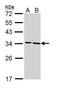 Secreted Frizzled Related Protein 2 antibody, PA5-29390, Invitrogen Antibodies, Western Blot image 
