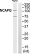 Non-SMC Condensin I Complex Subunit G antibody, TA315720, Origene, Western Blot image 