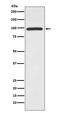 3-Hydroxy-3-Methylglutaryl-CoA Reductase antibody, M00643, Boster Biological Technology, Western Blot image 