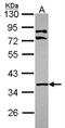 LIM and senescent cell antigen-like-containing domain protein 1 antibody, NBP2-19354, Novus Biologicals, Western Blot image 